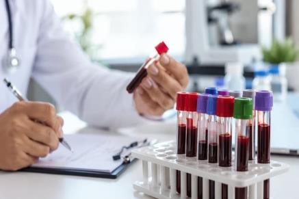 Yaptıramadığınız Ama Doktorunuzdan İstemeniz Gereken Kan Testleri